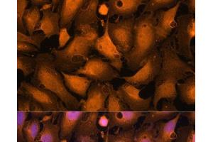 Immunofluorescence analysis of U-2OS cells using Caspase-3 Polyclonal Antibody at dilution of 1:100. (Caspase 3 antibody)