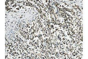 IHC analysis of Transketolase/TKT using anti-Transketolase/TKT antibody (ABIN7598957). (TKT antibody  (AA 1-116))