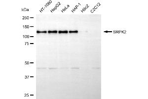Western blotting analysis using SRPK2 antibody (ABIN7800327). (SRPK2 antibody)