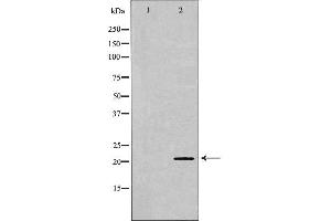 Western blot analysis of Mouse liver tissue lysates, using FGF2 Antibody. (FGF2 antibody  (C-Term))