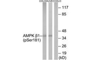Western blot analysis of extracts from COLO205 cells and HuvEc cells, using AMPK beta1 (Phospho-Ser181) Antibody. (PRKAB1 antibody  (pSer182))