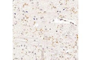 Immunohistochemistry of paraffin embedded mouse spinal cord using P2Y12 (ABIN7075321) at dilution of 1: 1400 (400x lens) (P2RY12 antibody)
