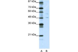 WB Suggested Anti-PLAGL1 Antibody Titration:  5. (PLAGL1 antibody  (N-Term))