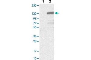 Western blot analysis of Lane 1: Negative control (vector only transfected HEK293T lysate). (ETAA1 antibody)