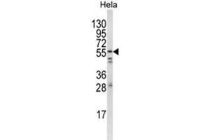 Western blot analysis of FYN Antibody (N-term) in Hela cell line lysates (35ug/lane).