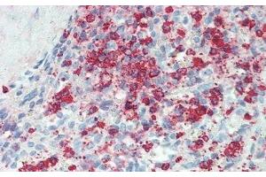 Immunohistochemistry (IHC) image for anti-Interleukin 22 Receptor, alpha 2 (IL22RA2) (AA 31-223) antibody (ABIN7435862)