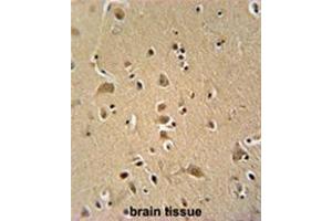 Immunohistochemistry (Paraffin-embedded Sections) (IHC (p)) image for anti-WAS/WASL Interacting Protein Family, Member 2 (WIPF2) (AA 392-419), (C-Term) antibody (ABIN955578)