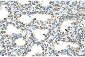 Immunohistochemical staining (Formalin-fixed paraffin-embedded sections) of human lung with FOXQ1 polyclonal antibody  at 4-8 ug/mL working concentration. (FOXQ1 antibody  (N-Term))