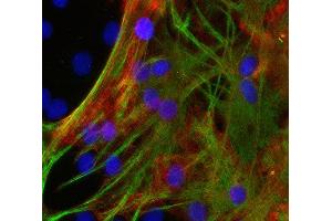 Indirect immunostaining of cultured PFA fixed rat astrocytes with anti-MCT 1 (dilution 1 : 500; red) and mouse anti-GFAP (cat. (MCTS1 antibody)