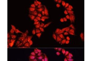 Immunofluorescence analysis of HeLa cells using ALDH9A1 Polyclonal Antibody at dilution of 1:100. (ALDH9A1 antibody)