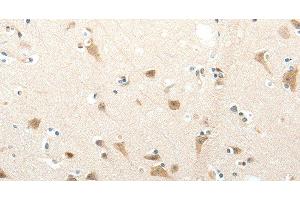 Immunohistochemistry of paraffin-embedded Human brain tissue using SEMA3D Polyclonal Antibody at dilution 1:50 (SEMA3D antibody)