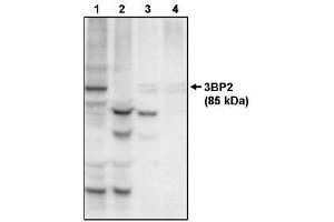 Image no. 1 for anti-SH3-Domain Binding Protein 2 (SH3BP2) antibody (ABIN264981) (SH3BP2 antibody)
