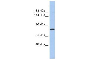 KLHL32 antibody used at 1 ug/ml to detect target protein. (KLHL32 antibody)