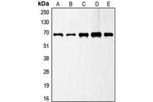 Western blot analysis of GAD1 expression in A549 (A), MCF7 (B), SP2/0 (C), PC12 (D), SKNSH (E) whole cell lysates. (GAD antibody  (C-Term))