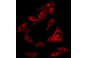 ABIN6267654 staining HuvEc by IF/ICC. (ERBB4 antibody  (pTyr1284))