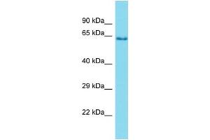 Western Blotting (WB) image for anti-Protease, Serine, 56 (PRSS56) (C-Term) antibody (ABIN2499340) (PRSS56 antibody  (C-Term))