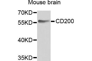 Western blot analysis of extracts of mouse brain, using CD200 antibody. (CD200 antibody)