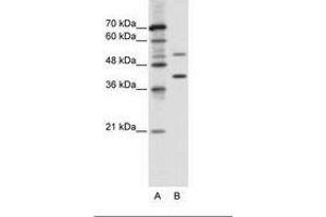 Image no. 1 for anti-REX4, RNA Exonuclease 4 Homolog (REXO4) (AA 270-319) antibody (ABIN6736107) (REXO4 antibody  (AA 270-319))