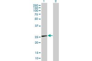 Western Blot analysis of CD8B expression in transfected 293T cell line by CD8B MaxPab polyclonal antibody. (CD8B antibody  (AA 1-243))