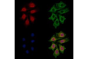 CNOT8 Antibody staining HepG2 cells by IF/ICC. (CNOT8 antibody  (Internal Region))