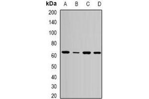 Western blot analysis of SPE39 expression in MCF7 (A), HepG2 (B), mouse liver (C), mouse kidney (D) whole cell lysates. (VIPAR antibody)