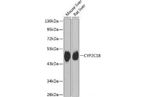 Western blot analysis of extracts of various cell lines using CYP2C18 Polyclonal Antibody at dilution of 1:1000. (CYP2C18 antibody)
