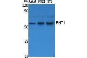 Western Blotting (WB) image for anti-Solute Carrier Family 29 (Nucleoside Transporters), Member 1 (SLC29A1) (N-Term) antibody (ABIN3187600) (SLC29A1 antibody  (N-Term))