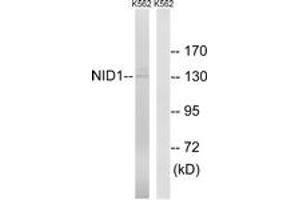Western blot analysis of extracts from K562 cells, using NID1 Antibody. (Nidogen 1 antibody  (AA 219-268))