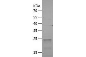 Western Blotting (WB) image for Coilin (COIL) (AA 1-203) protein (His tag) (ABIN7283719) (Coilin Protein (COIL) (AA 1-203) (His tag))