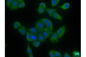 Immunofluorescence staining of Hela cells with ABIN7139823 at 1:166, counter-stained with DAPI.
