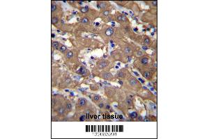 UGDH Antibody immunohistochemistry analysis in formalin fixed and paraffin embedded human liver tissue followed by peroxidase conjugation of the secondary antibody and DAB staining. (UGDH antibody  (C-Term))
