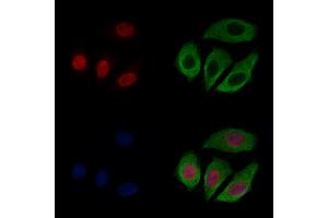 CASC5 Antibody staining Hela cells by IF/ICC.