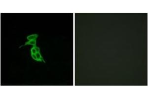 Immunofluorescence analysis of LOVO cells, using GPR143 Antibody. (GPR143 antibody  (AA 151-200))