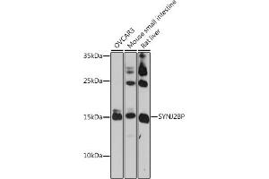 Western blot analysis of extracts of various cell lines, using SYNJ2BP antibody (ABIN7270667) at 1:1000 dilution. (SYNJ2BP antibody  (AA 1-145))