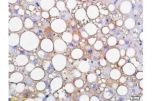 Formalin-fixed and paraffin embedded rat liver labeled with Anti-TIP47/M6PRBP1 Polyclonal Antibody, Unconjugated (ABIN681613) followed by conjugation to the secondary antibody and DAB staining (PLIN3 antibody  (AA 351-434))
