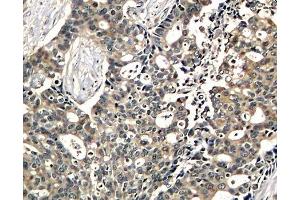 Immunohistochemistry (IHC) image for anti-DOK2 (DOK2) (pTyr299) antibody (ABIN3019935) (DOK2 antibody  (pTyr299))