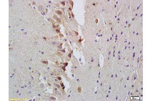 Formalin-fixed and paraffin embedded rat brain labeled with Rabbit Anti-STAT1 Polyclonal Antibody, Unconjugated  at 1:200 followed by conjugation to the secondary antibody and DAB staining (STAT1 antibody  (AA 251-380))