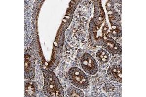 Immunohistochemical staining (Formalin-fixed paraffin-embedded sections) of human duodenum shows strong cytoplasmic positivity in glandular cells. (UQCRC1 antibody)