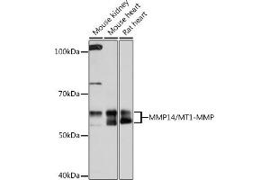 Western blot analysis of extracts of various cell lines, using MMP14/MMP14/MT1-MMP Rabbit mAb (ABIN7268420) at 1:1000 dilution. (MMP14 antibody)