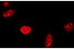 Immunofluorescent analysis of RAD17 staining in A549 cells. (RAD17 antibody  (C-Term))
