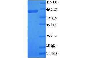 Arylsulfatase B Protein (ARSB) (AA 37-533) (His-SUMO Tag)