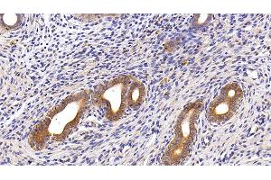 Immunohistochemistry (IHC) image for anti-Keratin 18 (KRT18) (AA 238-396) antibody (ABIN7433288)