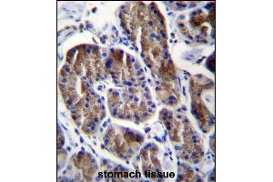 RPS4Y1 Antibody (Center) (ABIN656730 and ABIN2845954) immunohistochemistry analysis in formalin fixed and paraffin embedded human stomach tissue followed by peroxidase conjugation of the secondary antibody and DAB staining. (RPS4Y1 antibody  (AA 76-105))