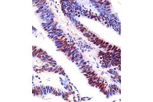 Immunohistochemistry (Paraffin-embedded Sections) (IHC (p)) image for anti-Enhancer of Zeste Homolog 2 (EZH2) antibody (ABIN659002)