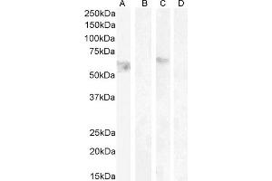 ABIN185484 (1 μg/mL) staining of HeLa lysate non-glycosylated (A) + peptide (B) and (0. (CNR1 antibody  (Internal Region))