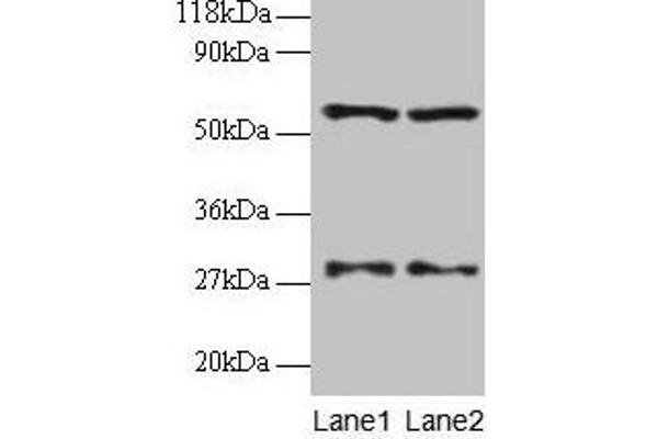 Seryl-tRNA Synthetase (SARS) (AA 2-233) antibody