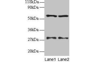 Western blot All lanes: SARS antibody at 2 μg/mL Lane 1: EC109 whole cell lysate Lane 2: 293T whole cell lysate Secondary Goat polyclonal to rabbit IgG at 1/15000 dilution Predicted band size: 59 kDa Observed band size: 59 kDa (Seryl-tRNA Synthetase (SARS) (AA 2-233) antibody)