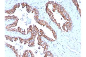 Immunohistochemistry (IHC) image for anti-Prostate Transmembrane Protein, Androgen Induced 1 (PMEPA1) antibody (ABIN6940417)
