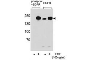 Western blot analysis of extracts from A431 cells,untreated or treated with EGF, using p-EGFR antibody (left) or nonphos Ab (right). (EGFR antibody  (pTyr1069))