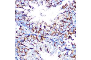 Immunohistochemistry of paraffin-embedded mouse testis using Muscarinic AChR M2 (Muscarinic AChR M2 ) Rabbit mAb (ABIN7266346) at dilution of 1:100 (40x lens). (Muscarinic Acetylcholine Receptor M2 antibody)